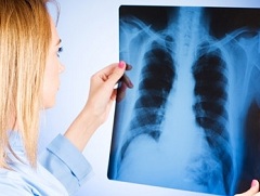 Рентгенологическое исследование метод диагностики пневмофиброза легких